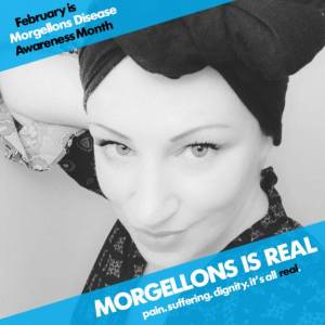 This image has an empty alt attribute; its file name is about.jpg